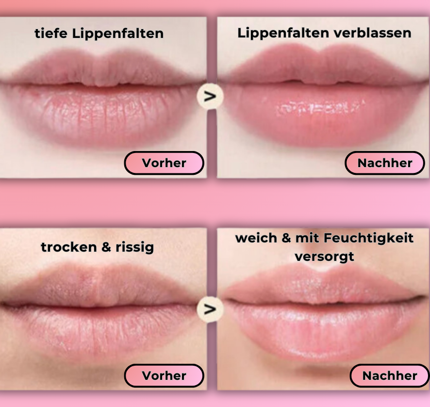 DERMA™ - Lippenbooster