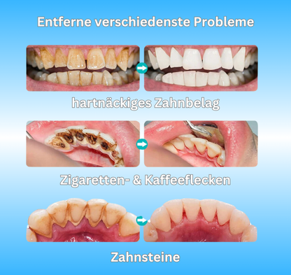 Medent - Zahnsteinentferner